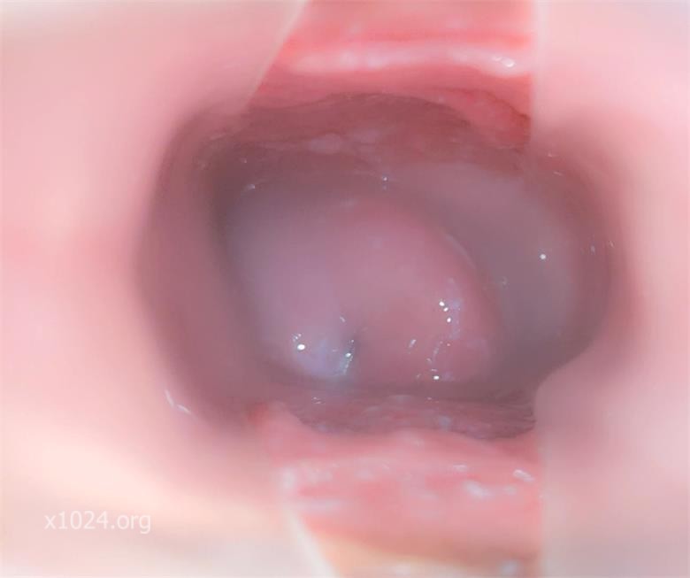 (1)