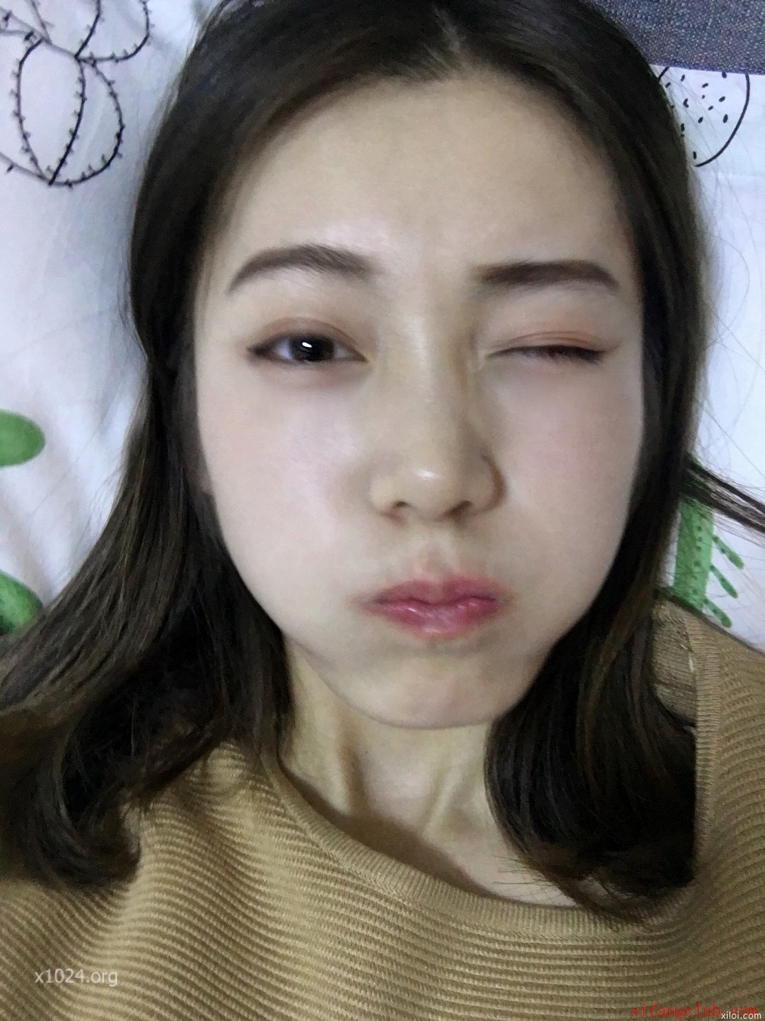 (2)